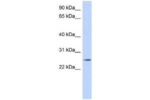 Western Blotting (WB) image for anti-Na+/K+ Transporting ATPase Interacting 4 (NKAIN4) (Middle Region) antibody (ABIN636084)
