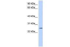 NKAIN4 antibody used at 1 ug/ml to detect target protein. (NKAIN4 抗体  (Middle Region))