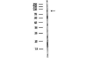 anti-Zinc Finger, FYVE Domain Containing 1 (ZFYVE1) antibody