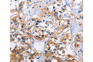 Immunohistochemistry (IHC) image for anti-Capping Protein (Actin Filament) Muscle Z-Line, alpha 3 (CAPZA3) antibody (ABIN2825233) (CAPZA3 抗体)