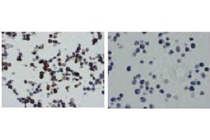 Immunohistochemistry (IHC) image for anti-Tumor Necrosis Factor (Ligand) Superfamily, Member 13b (TNFSF13B) antibody (ABIN1449224) (BAFF 抗体)