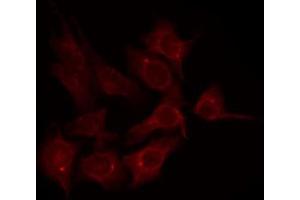 ABIN6274713 staining K562 by IF/ICC. (AGPAT3 抗体  (Internal Region))