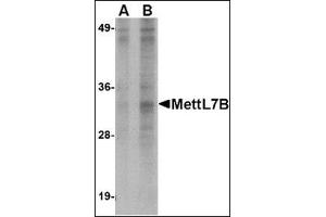 Western blot analysis of MettL7B in Jurkat lysate with this product at (A) 2 and (B) 4 μg/ml. (METTL7B 抗体  (N-Term))