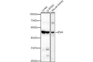 Western blot analysis of extracts of various cell lines, using IFI44 antibody (ABIN6135120, ABIN6142168, ABIN6142169 and ABIN6224213) at 1:1000 dilution. (IFI44 抗体)