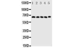 Western Blotting (WB) image for anti-Prostaglandin-Endoperoxide Synthase 2 (Prostaglandin G/H Synthase and Cyclooxygenase) (PTGS2) (AA 589-604), (C-Term) antibody (ABIN3044296) (PTGS2 抗体  (C-Term))