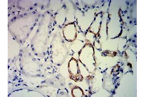 Immunohistochemical analysis of paraffin-embedded kidney tissues using ERCC1 mouse mAb with DAB staining. (ERCC1 抗体  (AA 1-297))