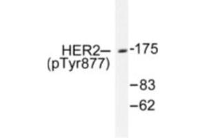 Image no. 1 for anti-Receptor tyrosine-protein kinase erbB-2 (ErbB2/Her2) (pTyr877) antibody (ABIN318038) (ErbB2/Her2 抗体  (pTyr877))