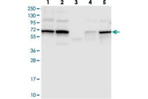 Western blot analysis of Lane 1: RT-4, Lane 2: U-251 MG, Lane 3: Human Plasma, Lane 4: Liver, Lane 5: Tonsil with TCHP polyclonal antibody  at 1:250-1:500 dilution. (TCHP 抗体)