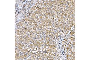 Immunohistochemistry of paraffin-embedded rat ovary using Niemann Pick C1 Rabbit mAb (ABIN7268911) at dilution of 1:50 (40x lens).