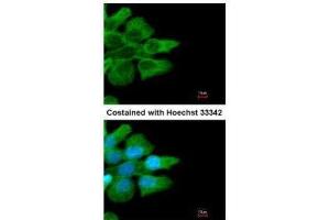 ICC/IF Image Immunofluorescence analysis of methanol-fixed A431, using CD32B, antibody at 1:500 dilution. (FCGR2B 抗体  (C-Term))