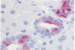 Immunohistochemistry (Paraffin-embedded Sections) (IHC (p)) image for anti-Prostaglandin E Receptor 2 (Subtype EP2), 53kDa (PTGER2) (Cytoplasmic Domain) antibody (ABIN213470)