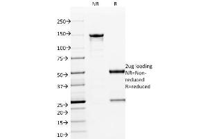 SDS-PAGE Analysis Purified ETS1 Mouse Monoclonal Antibody (ETS1/1801). (ETS1 抗体  (AA 137-230))