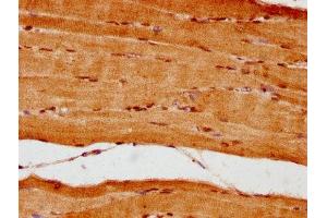 IHC image of ABIN7161836 diluted at 1:300 and staining in paraffin-embedded human skeletal muscle tissue performed on a Leica BondTM system. (NUP62 抗体  (AA 173-522))