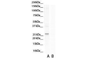 WB Suggested Anti-ASPH Antibody Titration:  0.