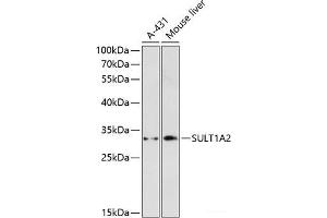 Western blot analysis of extracts of various cell lines using SULT1A2 Polyclonal Antibody at dilution of 1:3000. (SULT1A2 抗体)