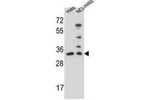 NTHL1 Antibody (Center R103) western blot analysis in Hela,NCI-H460 cell line lysates (35µg/lane). (Nth Endonuclease III-Like 1 (NTHL1) (AA 95-126), (Middle Region) 抗体)