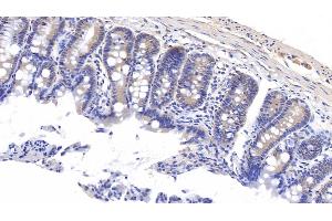 Detection of MT1 in Rat Colon Tissue using Polyclonal Antibody to Metallothionein 1 (MT1) (MT1 抗体  (AA 1-61))