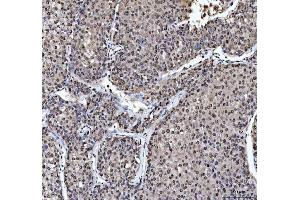 IHC analysis of hnRNP L/HNRNPL using anti-hnRNP L/HNRNPL antibody (ABIN7600130).