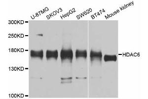 Western blot analysis of extracts of various cell lines, using HDAC6 antibody. (HDAC6 抗体)