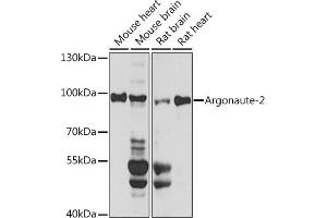 Western blot analysis of extracts of various cell lines, using Argonaute-2 antibody (ABIN6133693, ABIN6140045, ABIN6140047 and ABIN6221669) at 1:1000 dilution. (AGO2 抗体  (AA 1-100))
