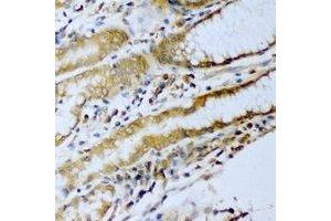 Immunohistochemical analysis of ERG staining in human stomach cancer formalin fixed paraffin embedded tissue section. (ERG 抗体)