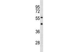 YY1 antibody western blot analysis in MDA-MB453 lysate.