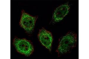 Fluorescent image of U251 cell stained with PGP 9. (UCHL1 抗体  (AA 187-214))