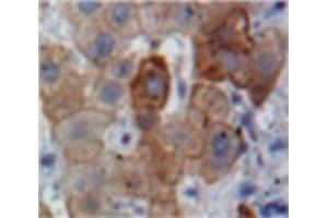 Used in DAB staining on fromalin fixed paraffin-embedded Liver tissue (APOB 抗体  (AA 3365-3548))
