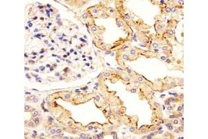 Immunohistochemical analysis of paraffin-embedded human kidney section using ATF6 beta antibody at 1:25. (ATF6B 抗体  (AA 560-589))