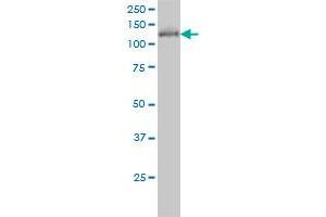 HDAC5 monoclonal antibody (M01), clone 4G2 Western Blot analysis of HDAC5 expression in COLO 320 HSR (HDAC5 抗体  (AA 330-429))