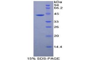 SDS-PAGE analysis of Human CKM Protein. (CKM 蛋白)