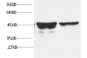 Western blot analysis of rat brain tissue, diluted at 1:5000. (GFAP 抗体)