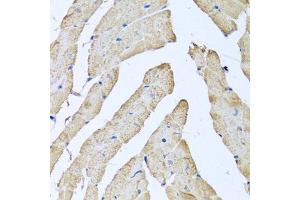 Immunohistochemistry of paraffin-embedded mouse heart using ATAD3B antibody (ABIN5974542) at dilution of 1/100 (40x lens). (ATAD3B 抗体)