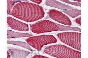 ABIN190878 (3. (TBC1D4 抗体  (Internal Region))