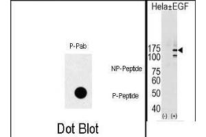 (LEFT)Dot blot analysis of Phospho-EGFR- polyclonal antibody (ABIN1881283 and ABIN2839662) on nitrocellulose membrane. (EGFR 抗体  (pTyr1069))