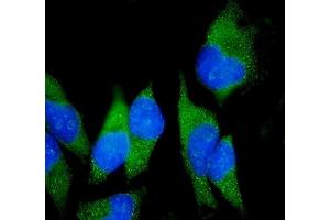 IF analysis of Claudin18/CLDN18 using anti-Claudin18/CLDN18 antibody (ABIN7601257). (Claudin 18 抗体  (AA 31-261))