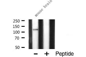 Western blot analysis of CARD6 expression in Mouse brain lysate (CARD6 抗体  (N-Term))