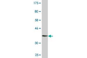 Western Blot detection against Immunogen (36. (LMTK3 抗体  (AA 1151-1250))