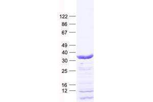 Validation with Western Blot (FOXR1 Protein (His tag))