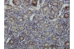 Immunoperoxidase of monoclonal antibody to STK38 on formalin-fixed paraffin-embedded human stomach. (STK38 抗体  (AA 365-465))