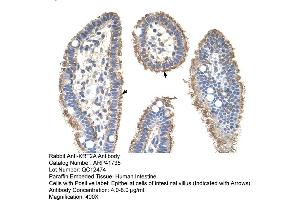 Rabbit Anti-KRT2AAntibody  Paraffin Embedded Tissue: Human Intestine Cellular Data: Epithelial cells of intestinal villas Antibody Concentration: 4. (Keratin 2 抗体  (Middle Region))