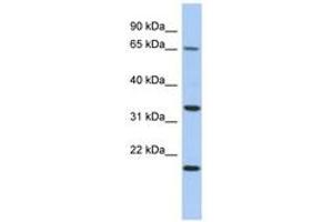 Image no. 1 for anti-Tumor Protein P63 Regulated 1 (TPRG1) (AA 35-84) antibody (ABIN6743909) (TPRG1 抗体  (AA 35-84))