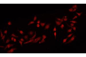 ABIN6269224 staining MCF-7 cells by IF/ICC.