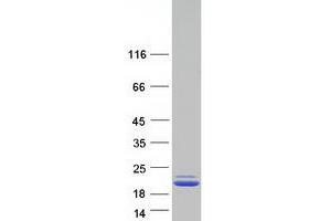 Western Blotting (WB) image for Periaxin (PRX) (Transcript Variant 1) protein (Myc-DYKDDDDK Tag) (ABIN2728663)