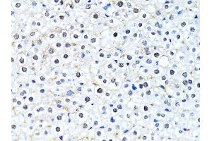 Immunohistochemistry of paraffin-embedded mouse liver using Histone H2B antibody (ABIN3015764, ABIN3015765, ABIN3015766 and ABIN6219109) at dilution of 1:100 (40x lens). (Histone H2B 抗体  (AA 1-126))