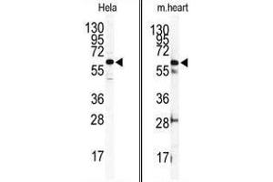 (LEFT) Western blot analysis of anti-ILK2/ILK1 Antibody (C-term) in Hela cell line lysates (35ug/lane). (ILK 抗体  (C-Term))