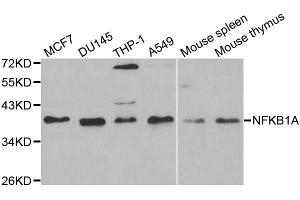 Western Blotting (WB) image for anti-Nuclear Factor of kappa Light Polypeptide Gene Enhancer in B-Cells Inhibitor, alpha (NFKBIA) (AA 1-317) antibody (ABIN6144580)