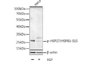 Western blot analysis of extracts of HeLa cells, using Phospho-HSP27/HSPB1-S15 antibody  at 1:1000 dilution. (HSP27 抗体  (pSer15))