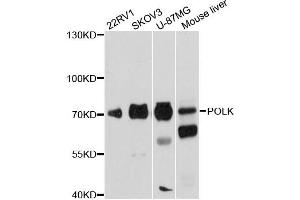 Western blot analysis of extracts of various cell lines, using POLK antibody (ABIN6290755) at 1:1000 dilution. (POLK 抗体)