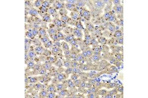 Immunohistochemistry of paraffin-embedded mouse liver using HSD17B13 Antibody. (HSD17B13 抗体  (AA 20-300))